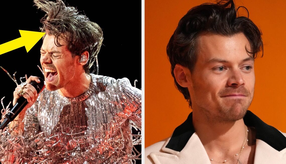 People Are Praising Harry Styles’s “Refreshing” Response To All Those Hair Transplant And Wig Rumors