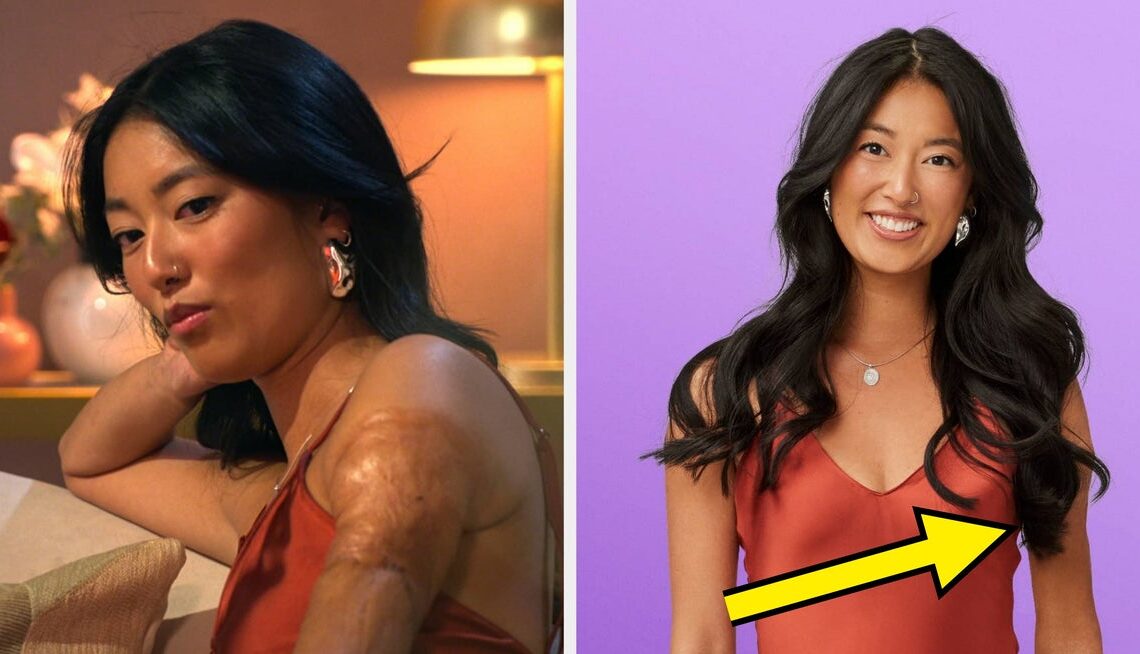 "Love Is Blind" Star Emma Responded After Netflix Seemingly Edited Her Scarring Out Of Promo Pics